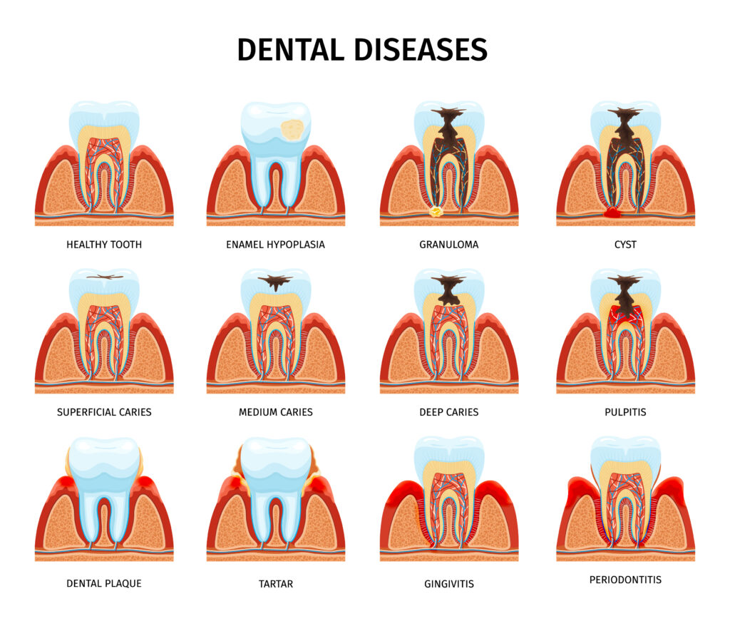 Dental Anatomy Problems Set