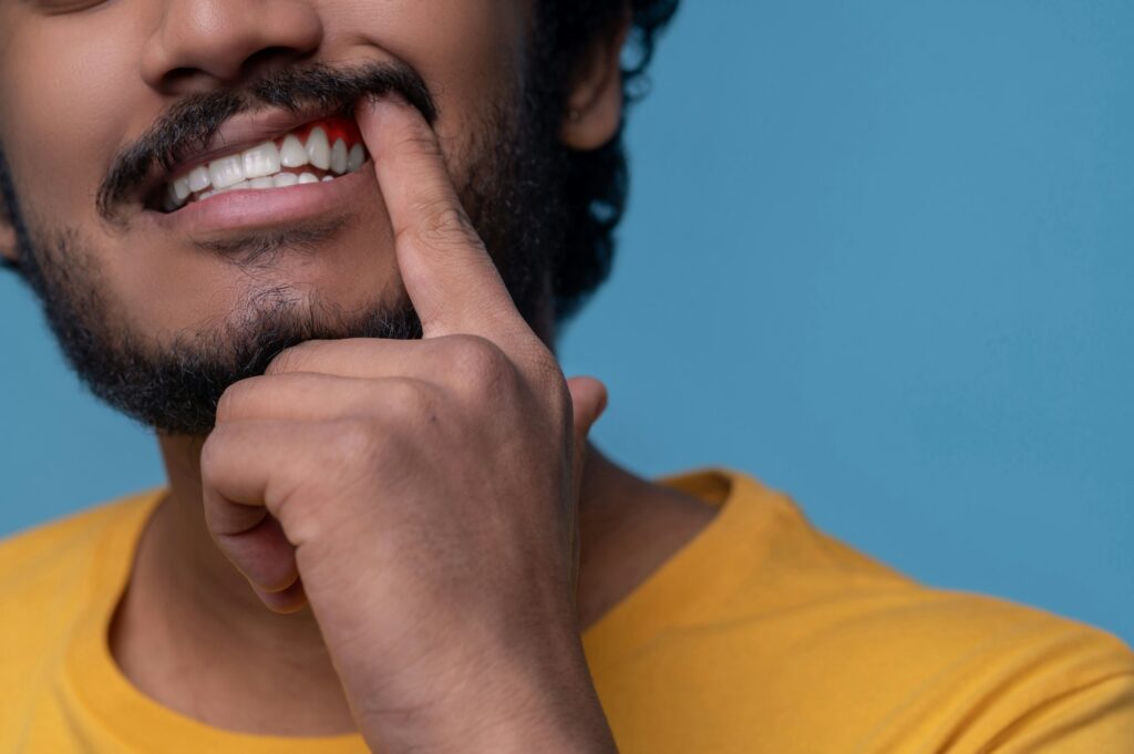 adult-man-showing-his-periodontal-disease-before-the-camera-1024x681