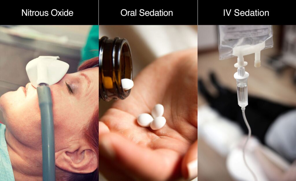 sedation4-1024x627