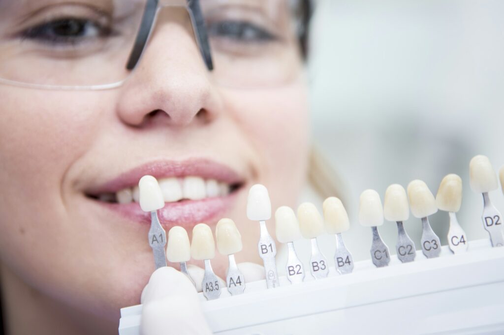 woman-at-the-dentist-choosing-color-for-teeth-whitening-1024x682